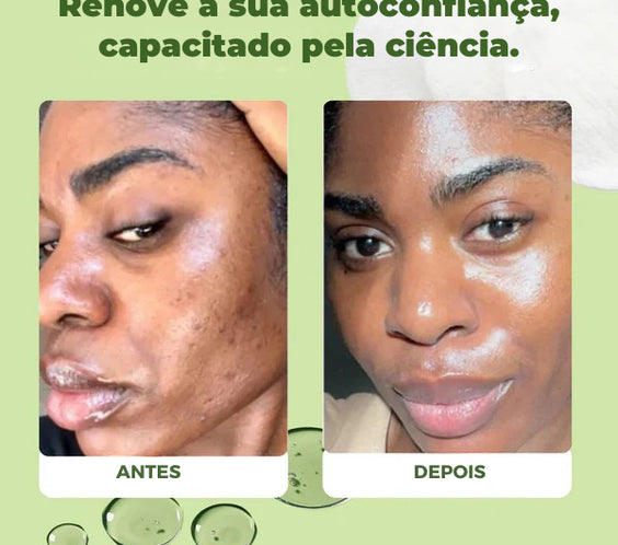 Jiyu SkinCare - Cuidados com a Pele Coreano para Manchas Escuras, Rugas e Pele Opaçada