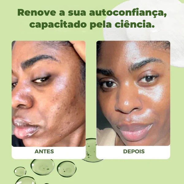 Jiyu SkinCare - Cuidados com a Pele Coreano para Manchas Escuras, Rugas e Pele Opaçada